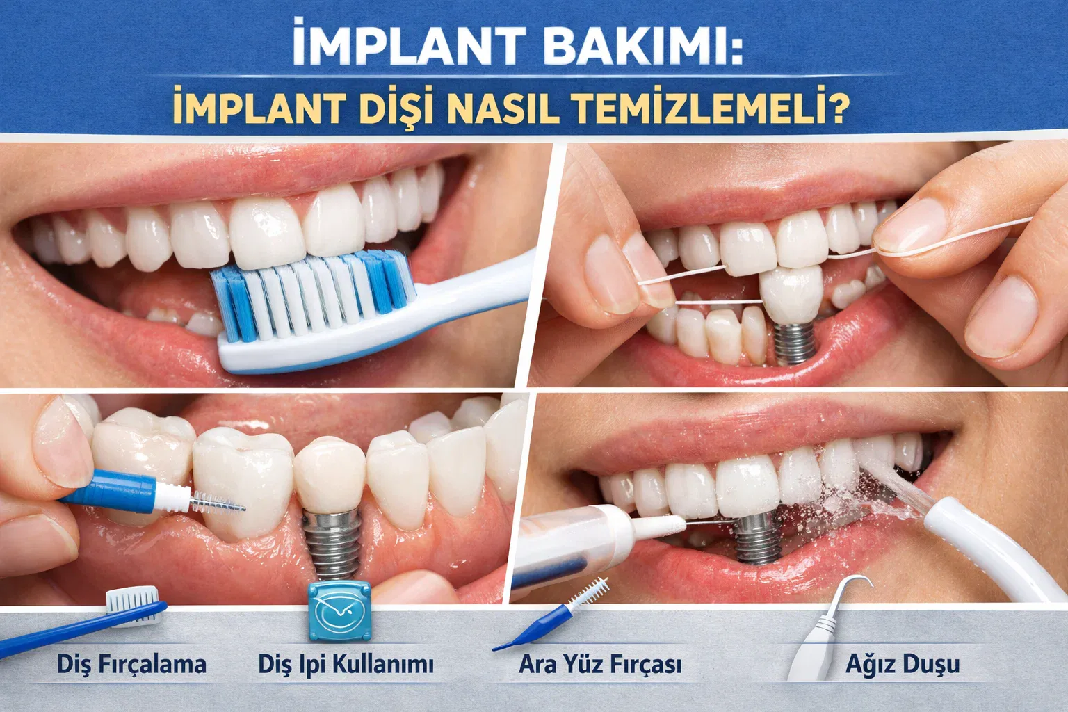 Dört kareli görselde implant çevresinde fırça, diş ipi, ara yüz fırçası ve ağız duşu
